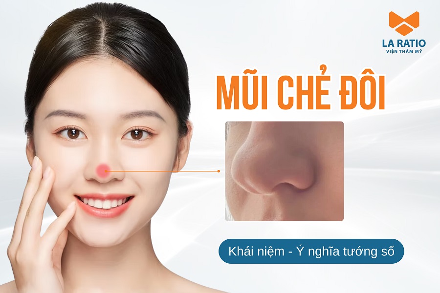 Mũi chẻ là như thế nào? Có ý nghĩa gì? Tốt hay xấu?