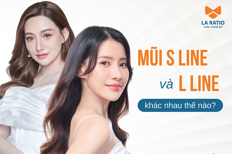Mũi S Line và L Line khác nhau thế nào? Nên lựa chọn dáng mũi nào?