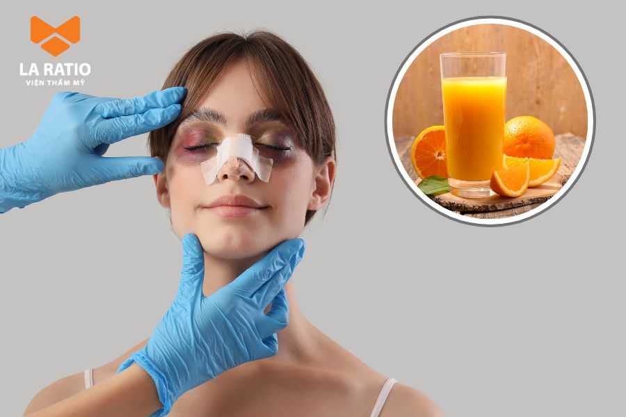 Nâng mũi có được uống nước cam không? Bạn hoàn toàn có thể uống nước cam sau nâng mũi