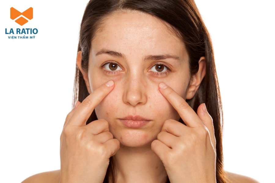 Đôi mắt vô thần đôi có thể là do bẩm sinh, khi cấu trúc mí mắt không đều Đôi mắt vô thần đôi có thể là do bẩm sinh, khi cấu trúc mí mắt không đều