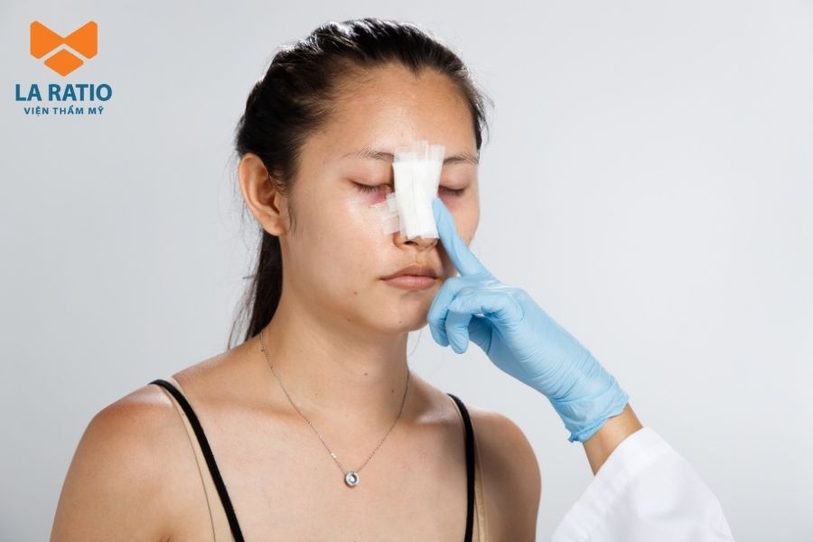 Nâng mũi Trung Hoa không thể khắc phục những vấn đề mũi phức tạp Nâng mũi Trung Hoa không thể khắc phục những vấn đề mũi phức tạp