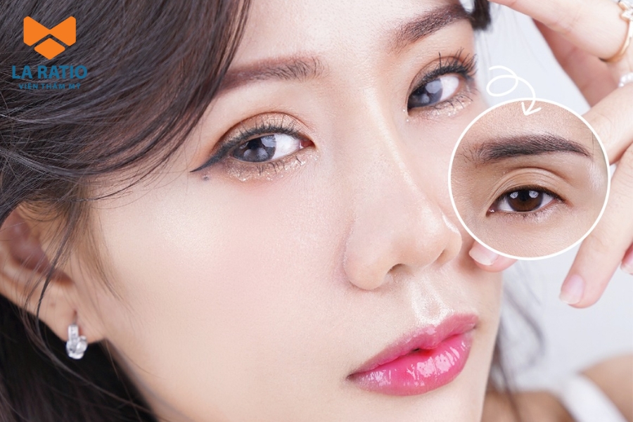 Phẫu thuật thẩm mỹ có thể giúp khắc phục các khuyết điểm của mắt rắn