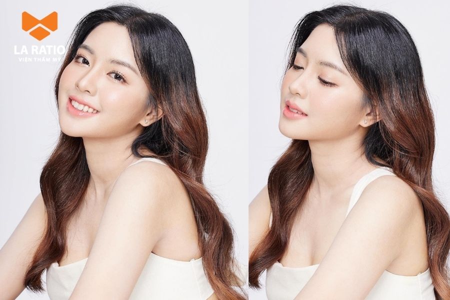 Dáng mũi Trung Hoa giúp tôn lên nét thanh tú của khuôn mặt Á Đông Dáng mũi Trung Hoa giúp tôn lên nét thanh tú của khuôn mặt Á Đông