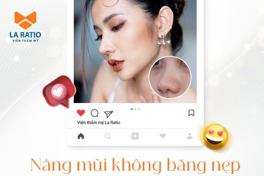 Nâng mũi không băng nẹp không để lại vết tích thẩm mỹ