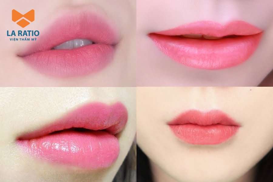 Phun môi hồng baby là gì? Phun môi hồng baby là gì?