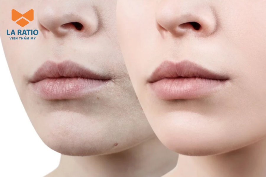 Màu hồng baby có thể che lấp tình trạng môi thâm, xỉn màu Màu hồng baby có thể che lấp tình trạng môi thâm, xỉn màu