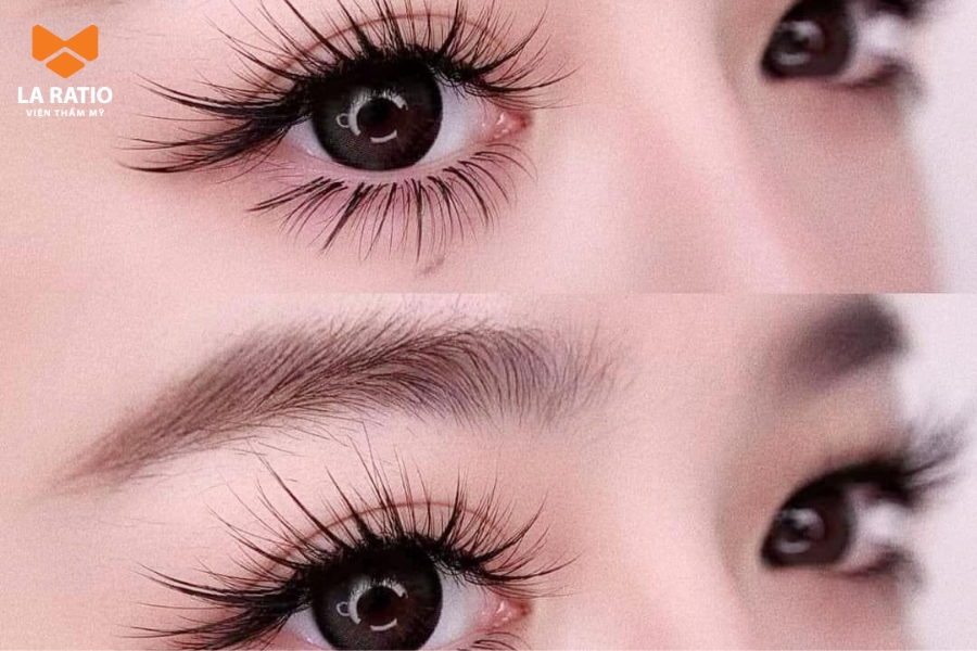 Cắt mí xong bao lâu thì được nối mi? Khoảng 2 - 3 tháng Cắt mí xong bao lâu thì được nối mi? Khoảng 2 - 3 tháng