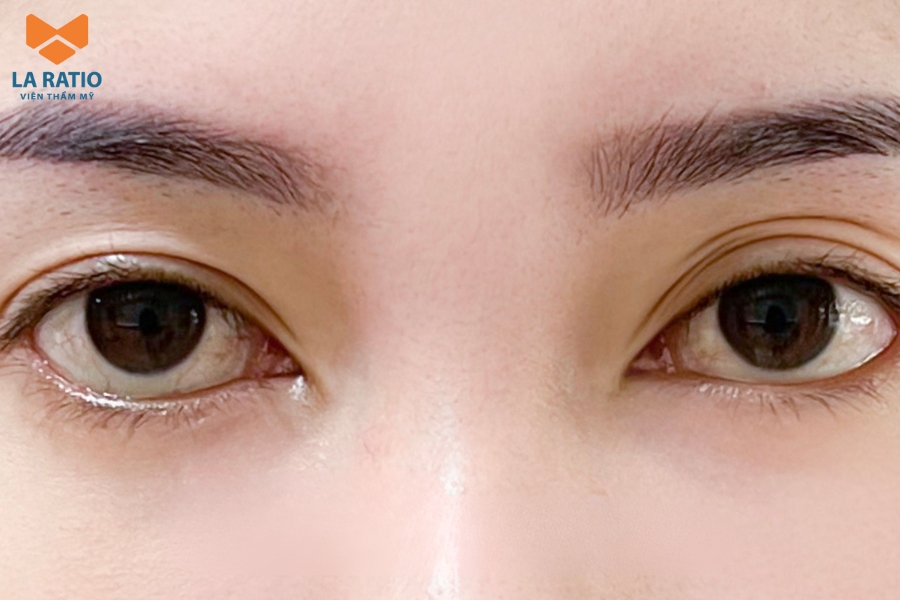 Có thể cân nhắc chỉnh sửa nếu dáng mắt chim én chưa hài hòa