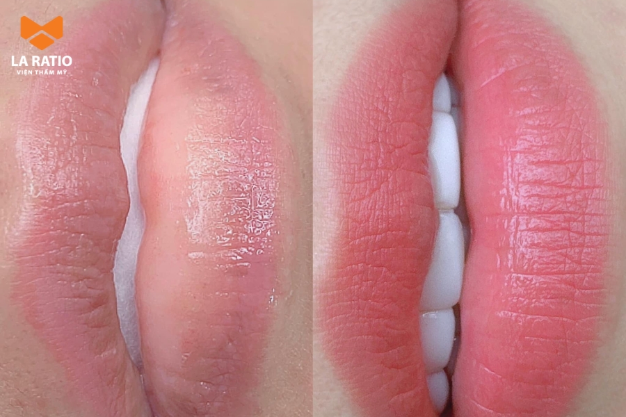 Môi sau khi bong lên màu tự nhiên, tôn da và không bị sến Môi sau khi bong lên màu tự nhiên, tôn da và không bị sến