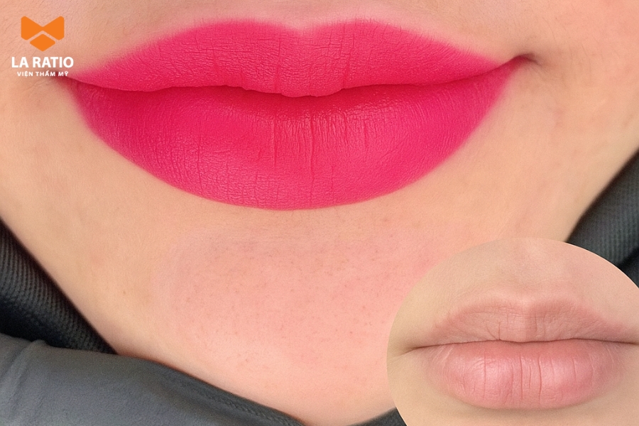 Khách hàng vữa mới phun môi xong tại La Ratio, môi vẫn chưa bong Khách hàng vữa mới phun môi xong tại La Ratio, môi vẫn chưa bong