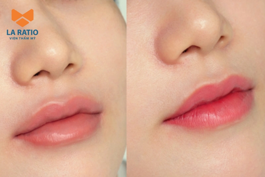 Hình ảnh thực tế sau phun xăm môi hồng đào Hình ảnh thực tế sau phun xăm môi hồng đào