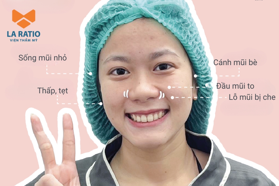 Mũi củ tỏi có đầu mũi tròn, cánh mũi rộng giống như dáng của củ tỏi