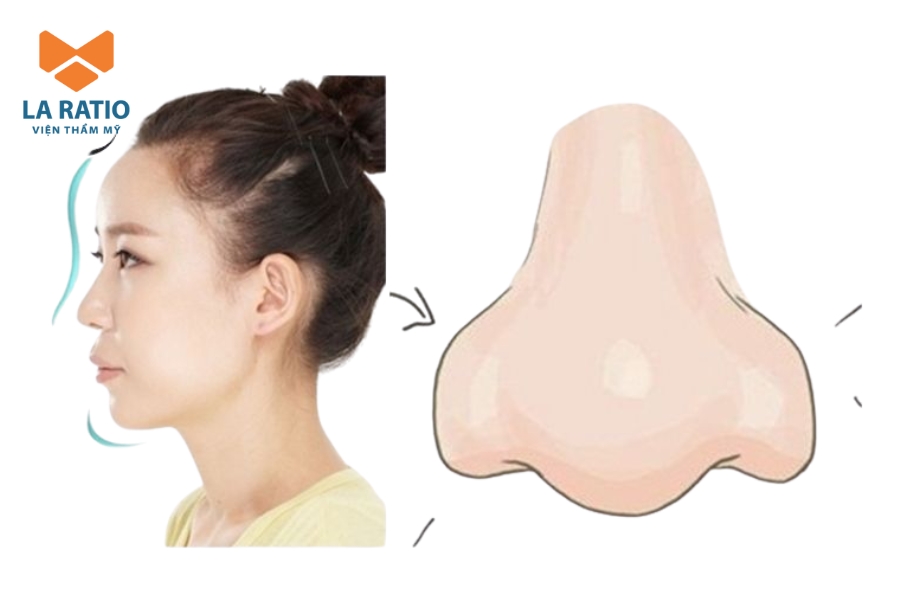 Dáng mũi kỳ lân đẹp hay xấu còn tùy thuộc vào gu thẩm mỹ của từng người