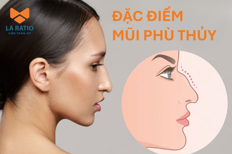 Đặc điểm nhận biết của mũi phù thủy Đặc điểm nhận biết của mũi phù thủy