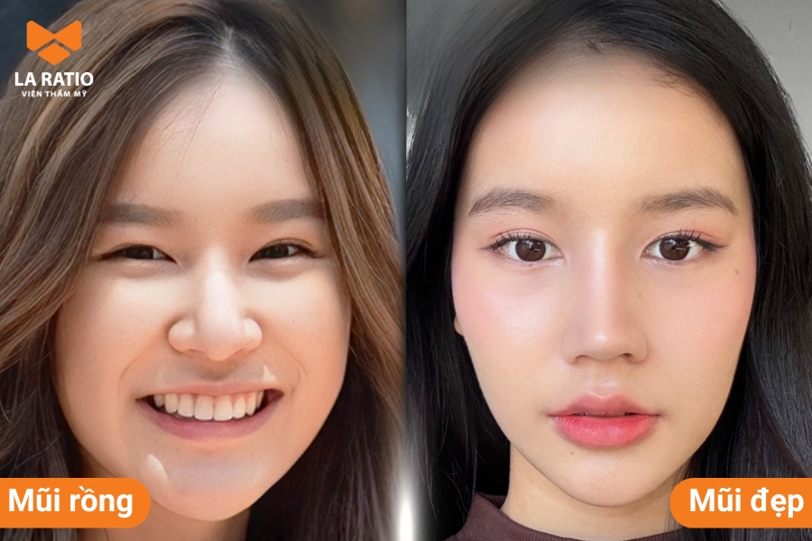 Mũi rồng tốt trong nhân tướng học nhưng lại chưa đẹp theo quan điểm thẩm mỹ