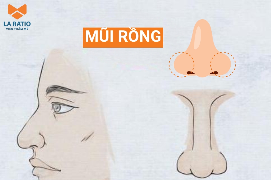 Hình ảnh mũi rồng: Mũi có phần đầu mũi hướng xuống dưới giống như đầu của con rồng
