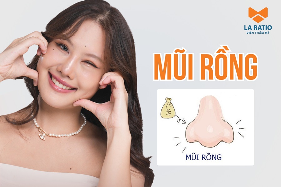 Mũi rồng là gì? Người có mũi rồng có nên sửa mũi không?