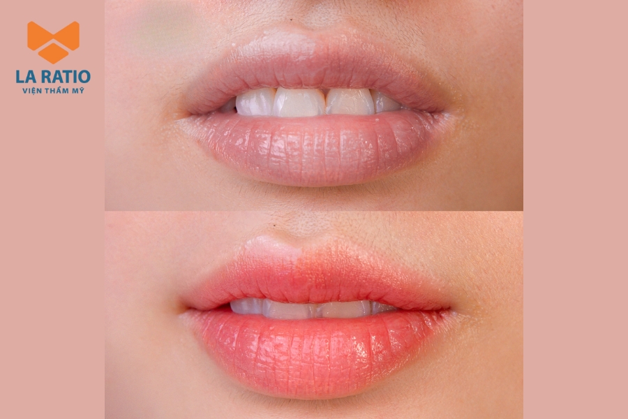 Hình ảnh khách hàng sau khi phun môi hồng baby, lên màu chuẩn Hình ảnh khách hàng sau khi phun môi hồng baby, lên màu chuẩn