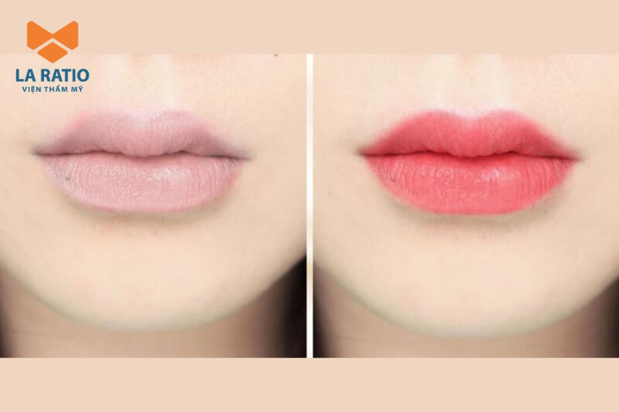 Hiệu ứng môi hồng đào căng mịn sau khi phun xăm hồng đào Hiệu ứng môi hồng đào căng mịn sau khi phun xăm hồng đào