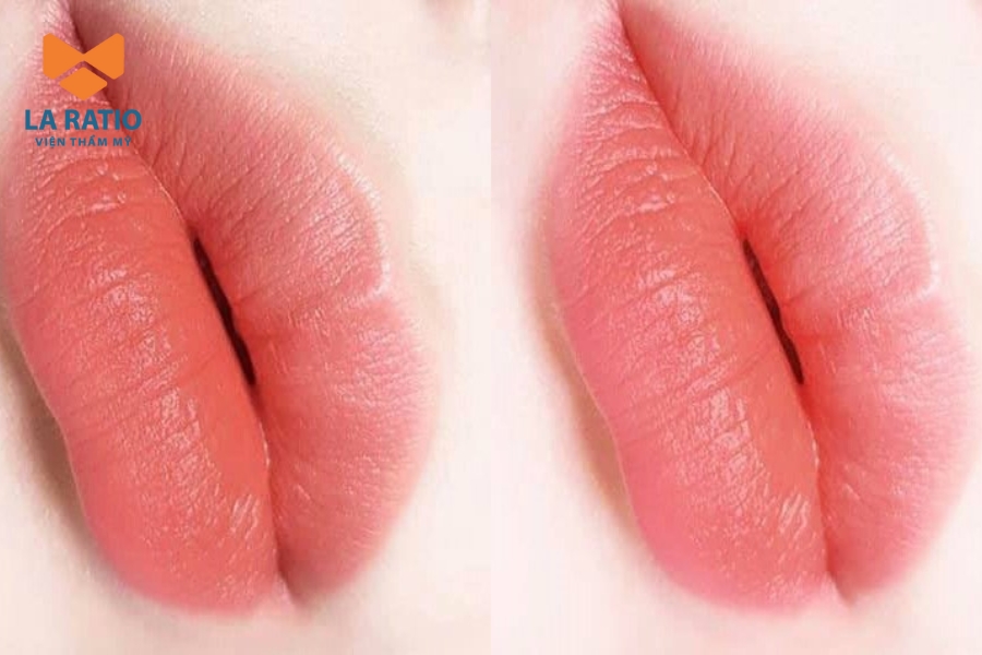 Phun môi màu hồng đào có đẹp không? Phun môi màu hồng đào có đẹp không?