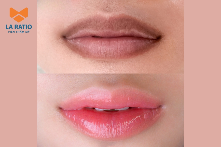 Ảnh thực tế khách hàng ngay sau khi phun môi công nghệ cao Ảnh thực tế khách hàng ngay sau khi phun môi công nghệ cao
