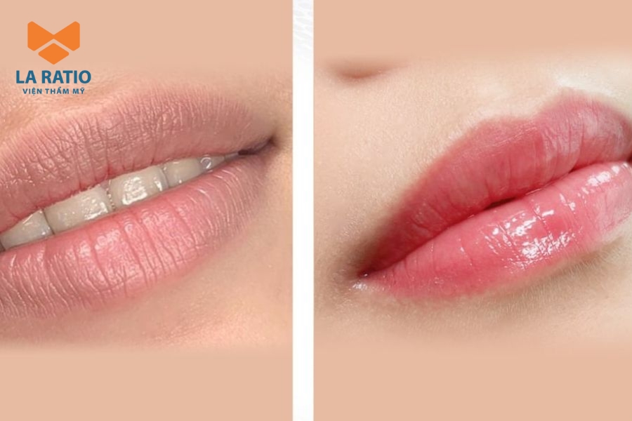 Khách hàng lựa chọn màu hồng baby để tôn nét dịu dàng và trẻ trung Khách hàng lựa chọn màu hồng baby để tôn nét dịu dàng và trẻ trung