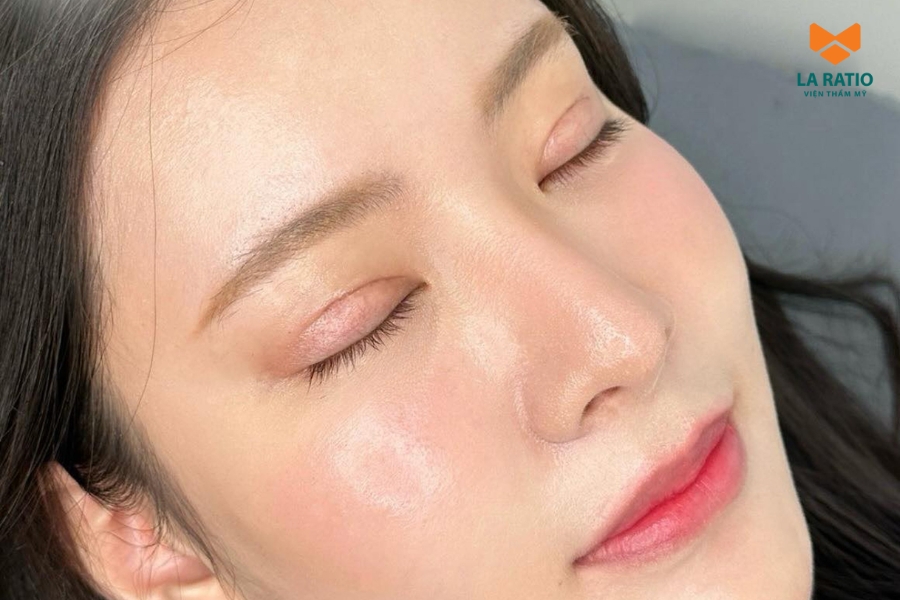 Thời gian cắt mí sau bao lâu thì đẹp tự nhiên tùy thuộc vào cơ địa, tay nghề bác sĩ và cách chăm sóc tại nhà Thời gian cắt mí sau bao lâu thì đẹp tự nhiên tùy thuộc vào cơ địa, tay nghề bác sĩ và cách chăm sóc tại nhà