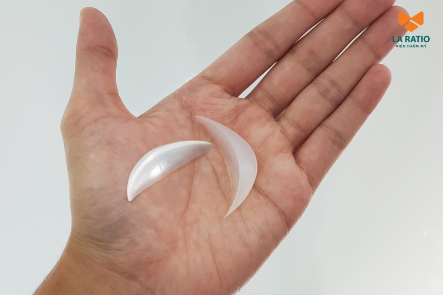 Độn cằm giữ được bao lâu phụ thuộc vào phương pháp mà khách hàng lựa chọn