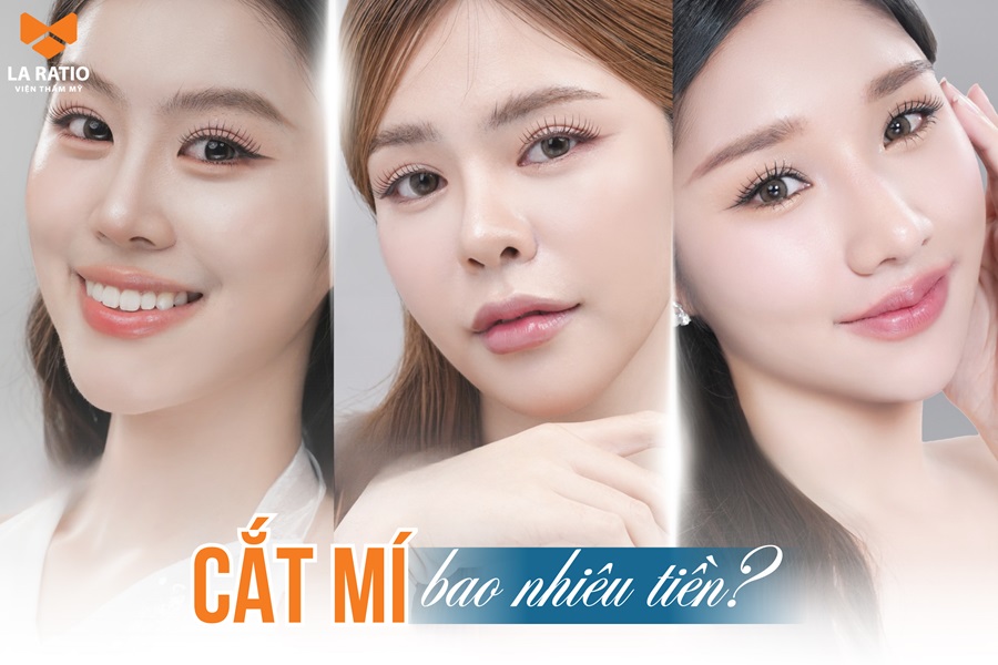 Cắt mí bao nhiêu tiền? Bảng giá mới nhất tại La Ratio Cắt mí bao nhiêu tiền? Bảng giá mới nhất tại La Ratio
