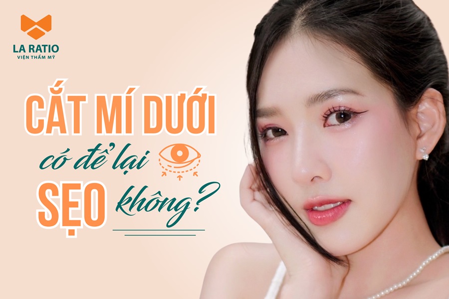 Cắt mí dưới có để lại sẹo không? Chuyên gia La Ratio giải đáp