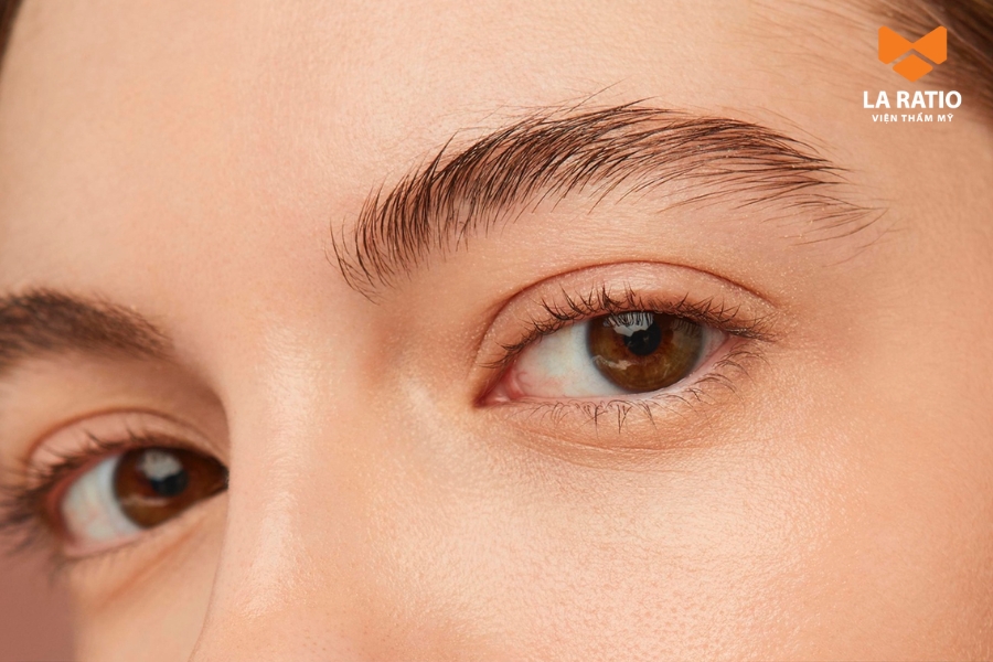 Không nên cắt mí giá rẻ ở những cơ sở kém uy tín Không nên cắt mí giá rẻ ở những cơ sở kém uy tín