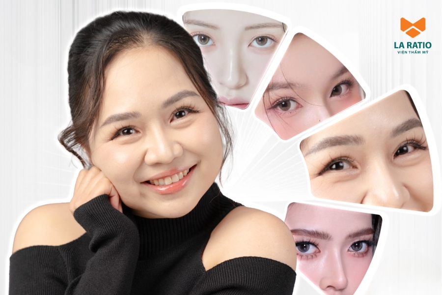 Cắt mí mắt ILID đẹp tự nhiên - Hạn chế để lại sẹo tại La Ratio