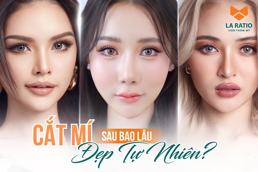 Cắt mí sau bao lâu thì đẹp tự nhiên, mí vào form ổn định Cắt mí sau bao lâu thì đẹp tự nhiên, mí vào form ổn định