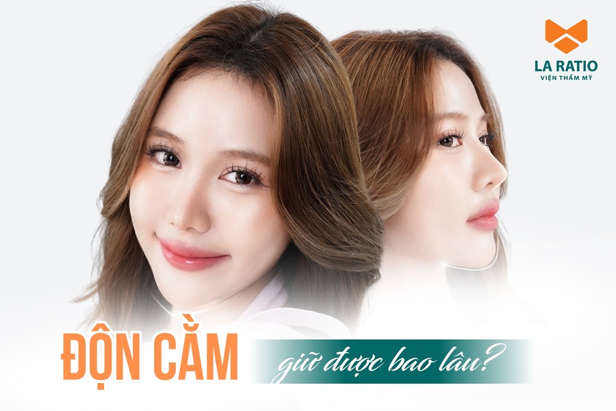 Độn cằm giữ được bao lâu? Có được vĩnh viễn không