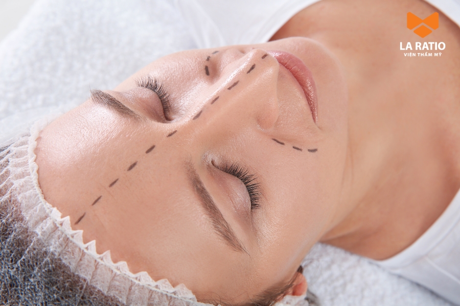 Nâng mũi bao lâu thì lành còn tùy thuộc vào tốc độ hồi phục của từng người