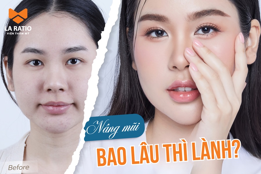 Nâng mũi bao lâu thì lành hẳn? Cách chăm sóc giúp mũi nhanh lành