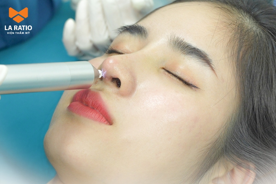 Khách hàng chiếu tia Plasma sau nâng mũi giúp hạn chế đau và sưng bầm