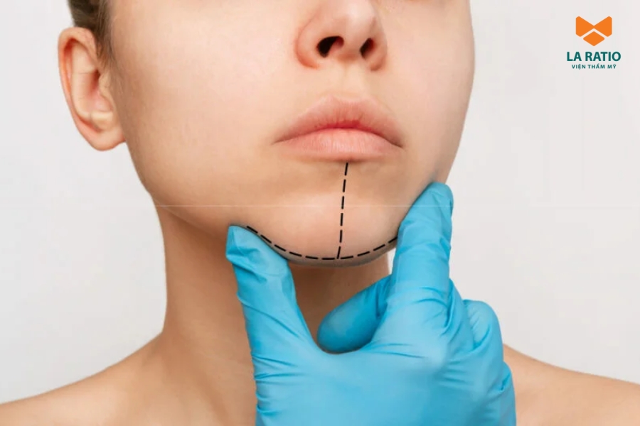 Độn cằm mang lại kết quả lâu dài, chỉ xâm lấn nhỏ, thời gian thực hiện nhanh chóng Độn cằm mang lại kết quả lâu dài, chỉ xâm lấn nhỏ, thời gian thực hiện nhanh chóng