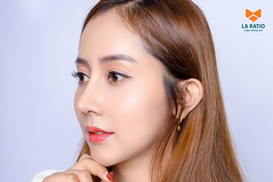 Nâng mũi bao lâu thì sinh hoạt bình thường? Sau 1 - 2 tuần