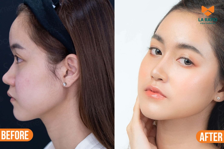 Thời gian hồi phục ở mỗi người là khác nhau