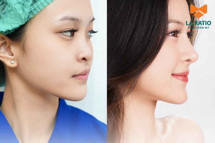 Chị đẹp thay đổi góc nghiêng, bật thần thái nhờ bàn tay vàng của bác sĩ Võ Thành Trung