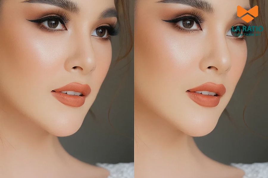 Các biến thể phổ biến của cam đất