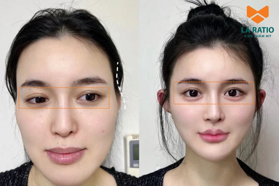 Cắt mắt Trung Hoa mang dấu ấn sắc sảo nhưng vẫn giữ nét mềm mại đặc trưng Á Đông.