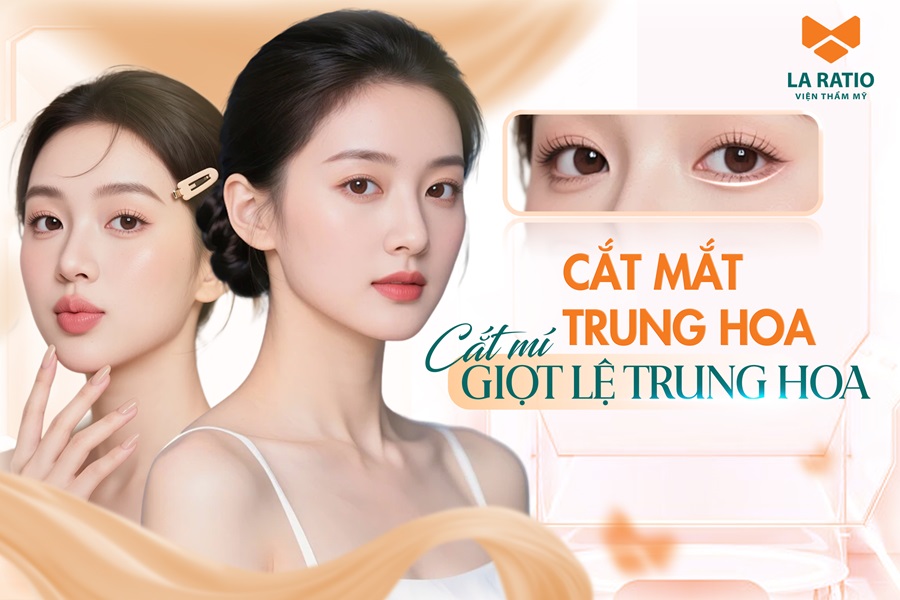 Cắt mắt Trung Hoa - Trào lưu thẩm mỹ Á Đông được nhiều phái đẹp ưa chuộng