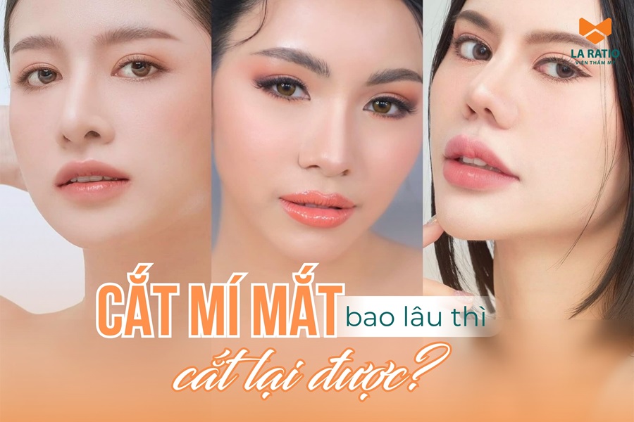Cắt mí bao lâu thì cắt lại được? Lưu ý khi cắt mắt lần 2 Cắt mí bao lâu thì cắt lại được? Lưu ý khi cắt mắt lần 2