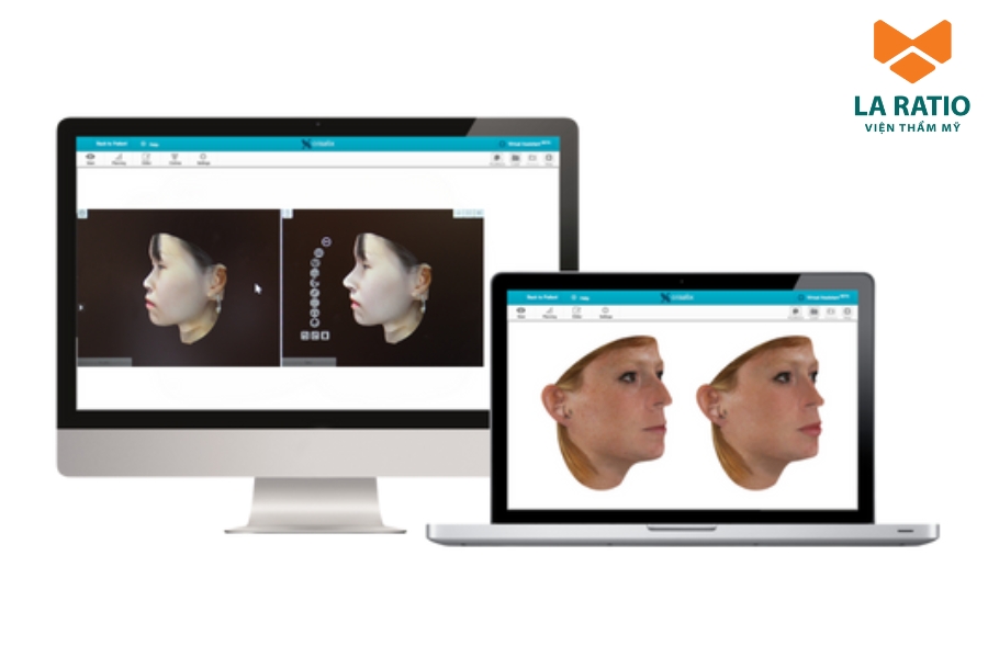 Công nghệ Crisalix mô phỏng dáng mũi trước - sau phẫu thuật