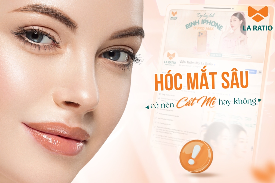 Hốc mắt sâu có nên cắt mí mắt? Chuyên gia La Ratio giải đáp Hốc mắt sâu có nên cắt mí mắt? Chuyên gia La Ratio giải đáp