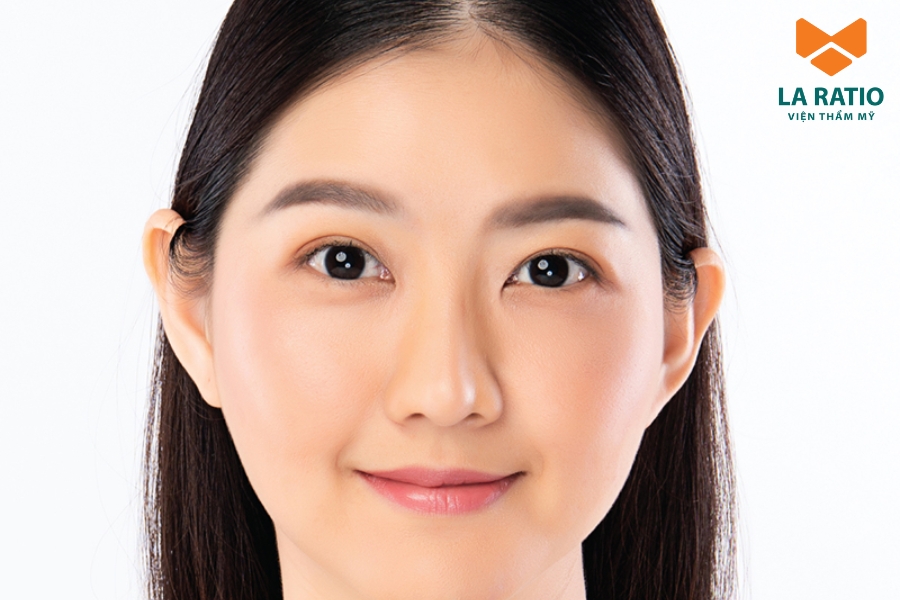 Nâng mũi sẽ giúp gương mặt tròn thon gọn và hài hòa hơn