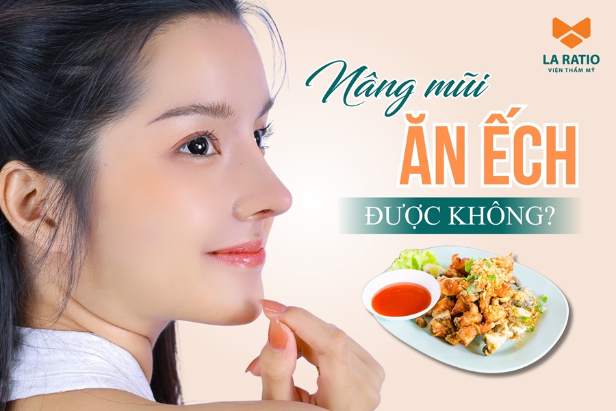 Nâng mũi ăn ếch được không? Chuyên gia La Ratio giải đáp