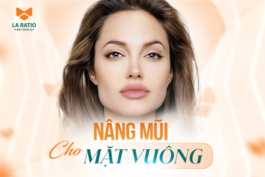 Mặt vuông có nên nâng mũi? Kỹ thuật nâng mũi cho mặt vuông
